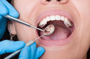 dental patient opening mouth with dental instruments