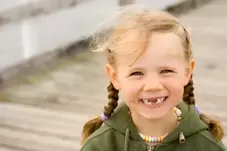 Little girl smiling with missing teeth