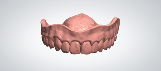 Digital dentures 