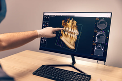 Dental Technology on Computer Screen