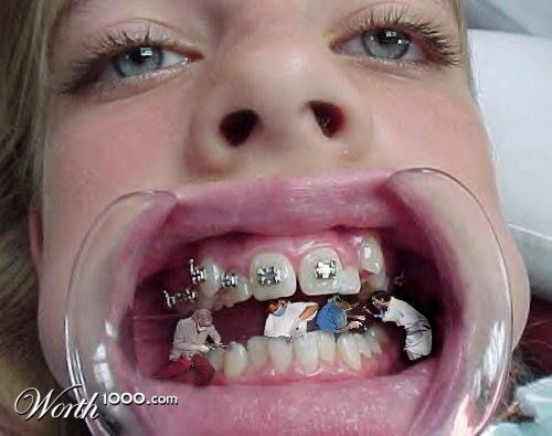 Picture of minature orthodontists working on a giant's mouth.